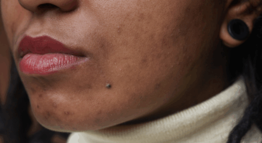 Close up of a Black woman's mouth